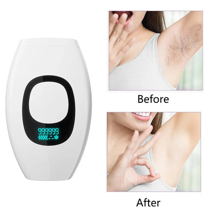 999,999 Flashes IPL Hair Removal Device with LCD Display